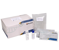Dengue Virus NS1 Antígeno Kit de prueba rápida (oro coloidal)